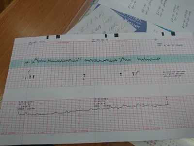 Причины плохого ктг и корректность лечения | Консультация гинеколога в  Минске на DOKTORA.BY - ВРАЧИ БЕЛАРУСИ