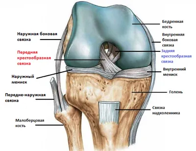 Случай из практики. Травма коленного сустава. Рентген с сюрпризом: разрыв  ПКС | Пикабу