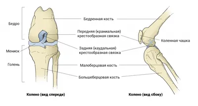 Разрыв крестообразной связки: причины и лечение