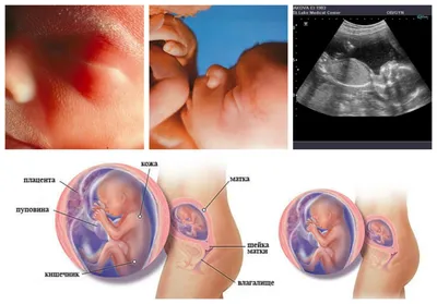 Видео как ребёнок развивается в утробе матери видео отправить мужу сообщить  видео｜Поиск в TikTok