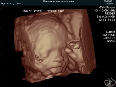 28 недель беременности | Клиника ведения беременности в Пятигорске