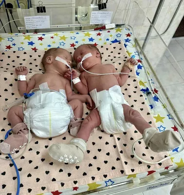 На Одесщине родилась первая тройня в этом году | ОБЩЕСТВЕННЫЙ ПРИБОЙ