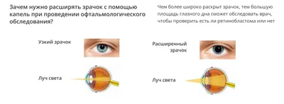 Что нужно знать о ретинобластоме? | фонд «Подари жизнь»