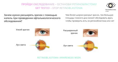 Ретинобластома: истории из жизни, советы, новости, юмор и картинки — Все  посты | Пикабу