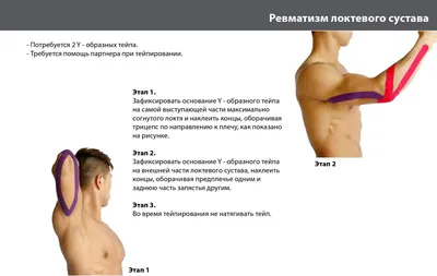 Ревматизм - как предотвратить и лечение в Одессе