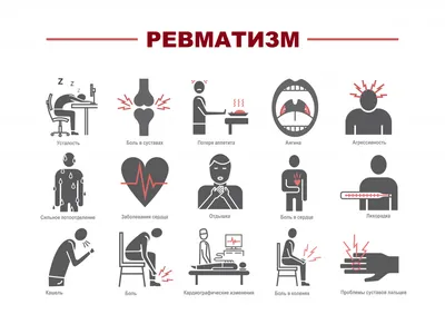 Ревматизм (острая ревматическая лихорадка): причины, симптомы и лечение в  статье ревматолога Семизарова И. В.