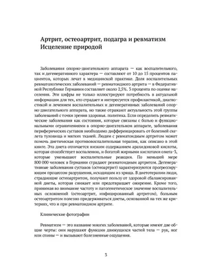 Ревматизм сегодня - региональная характеристика – тема научной статьи по  клинической медицине читайте бесплатно текст научно-исследовательской  работы в электронной библиотеке КиберЛенинка