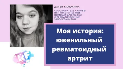 Ревматоидный артрит? | Портал радиологов