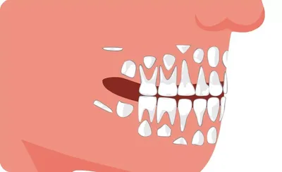 Почему молочные зубы у детей могут прорезаться не по порядку. | Стоматолог  Егор Щетинкин | Дзен