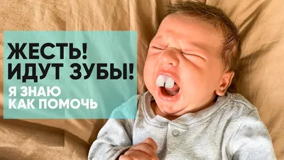 Всё, что нужно знать о зубах мудрости | Стоматология Киев