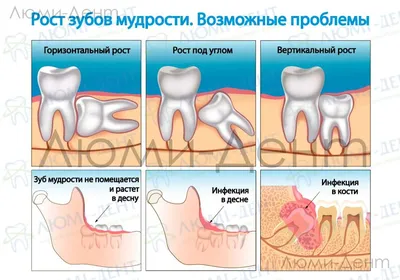 Режутся ли зубки? — 7 ответов | форум Babyblog