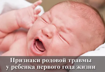 красное пятно у новорожденного гемангиома — 15 рекомендаций на Babyblog.ru