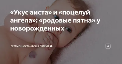 Пятно у новорожденного — 22 ответов | форум Babyblog