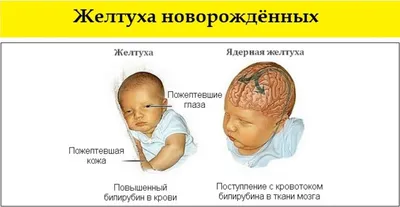 плоская гемангиома — 25 рекомендаций на Babyblog.ru