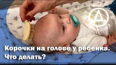 Родовая травма у новорожденного - YouTube