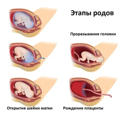 Роды: чего ожидать в процессе родов