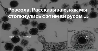 Детская розеола или внезапная экзантема - герпес 6 типа - причины,  клинические проявления и др. - YouTube