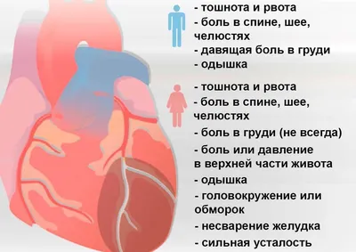 Инфаркт миокарда - причины появления, симптомы заболевания, диагностика и  способы лечения