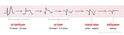 Самое большое кладбище – у медицины низового уровня: zakrit_dver —  LiveJournal