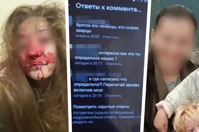 Не так поздоровался: 13-летний мальчик намеренно сломал руку своему  сверстнику в Таразе