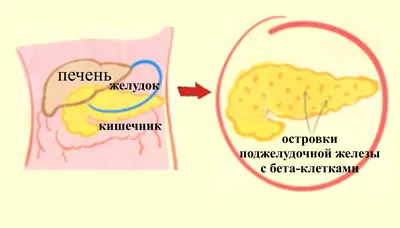 Диета при сахарном диабете