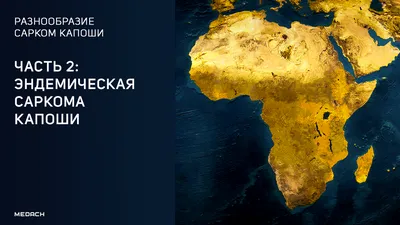 КЛИНИЧЕСКИЙ СЛУЧАЙ САРКОМЫ КАПОШИ Бухмарнова О.А. Первый Санкт-Петерб