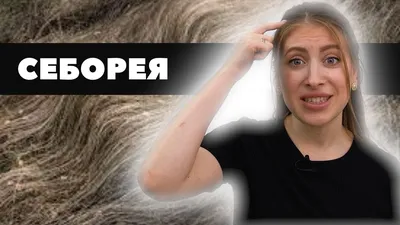 Жирная себорея головы – лечение, симптомы и причины жирной себореи головы