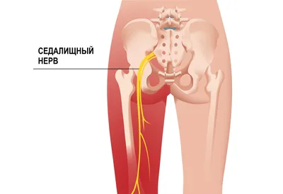 Седалищный нерв фото