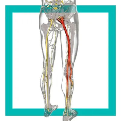 ➤ МРТ седалищного нерва в Киеве - Лайфскан