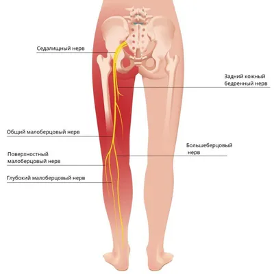 УЗИ периферических нервов (Ultrasound examination of the nerves) NEW