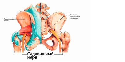 Ишиас – причины, симптомы, диагностика и способы лечения заболевания |  Клиника Будь Здоров