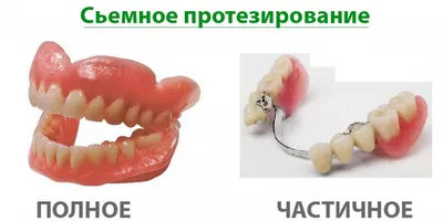 Съемные зубные протезы - Стоматологическая клиника Эстетика Новосибирск