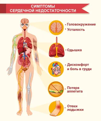 О чем говорят отеки?