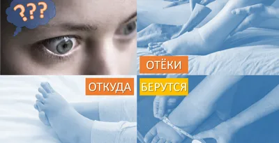 Эндокринолог Жито рассказал, как по характеру отеков понять, какой орган не  в порядке | DOCTORPITER