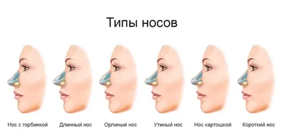 Почему отекают ноги и руки - причины и лечение с участием лимфатической  системы