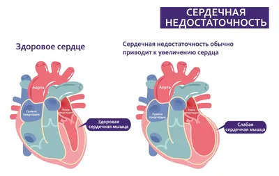 Отеки ног: причины и лечение, что делать - у женщин и мужчин| Медицинский  центр ФлебоПлюс