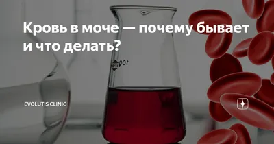 О чем говорит наличие крови в моче? | Клиника Радуга