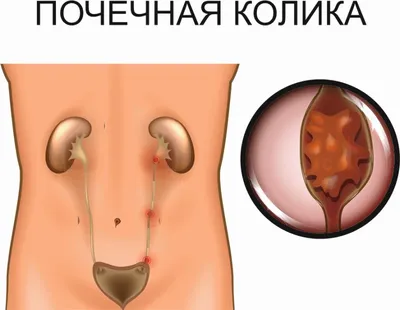 Клинический и биохимический анализ крови — что показывает — рассказывает  врач / Skillbox Media