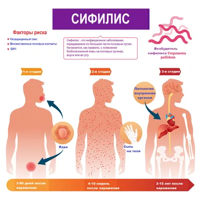 Сифилис: фото, как передается, симптомы, анализы, лечение