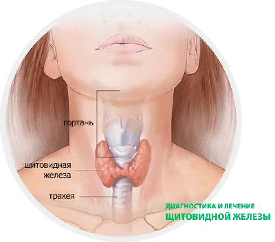 диагностика и лечение щитовидной железы