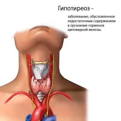 Что нужно знать о распространенных заболеваниях щитовидной железы | Молекула