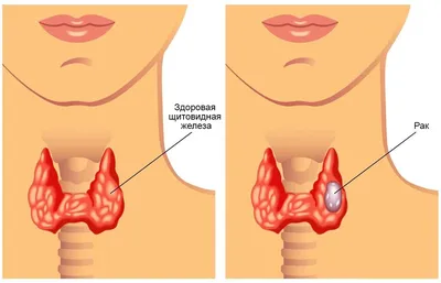 изображение человеческой щитовидной железы в одну линию. непрерывный  линейный рисунок внутренних органов человека щитовидная желез Иллюстрация  вектора - иллюстрации насчитывающей биохимии, гортанный: 225798590