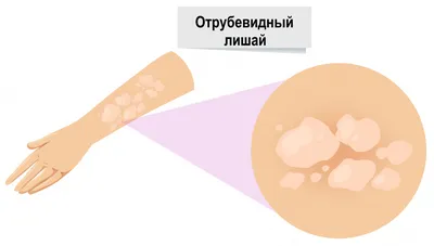 ᐉ Сухая кожа тела: как определить и этапы ухода за сухой кожей лица и тела