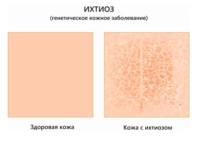 Что это за пятна? Что делать у ребёнка 9 месяцев, походу лишай, но точно |  MedAboutMe