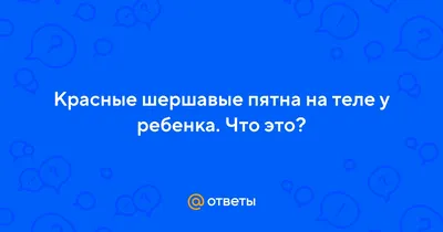 Вокруг родинки белое пятно: что это значит? | МЦ Лазерсвiт