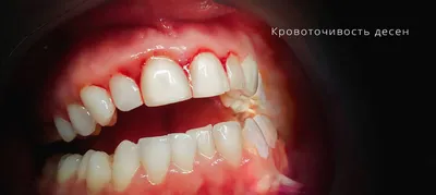 Читайте актуальные статьи на сайте стамотологии denten