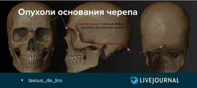 Оценка болей в шее и спине - Нарушения со стороны скелетно-мышечной и  соединительной ткани - Справочник MSD Профессиональная версия