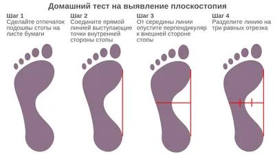 Болит стопа с внешней стороны - Вопрос ортопеду-травматологу - 03 Онлайн