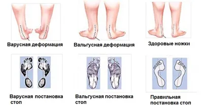 Блог клиники современной ортопедии и травматологии Ladisten