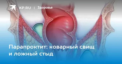 Уплотнение на попе ( возле анального отверстия) — 35 ответов | форум  Babyblog